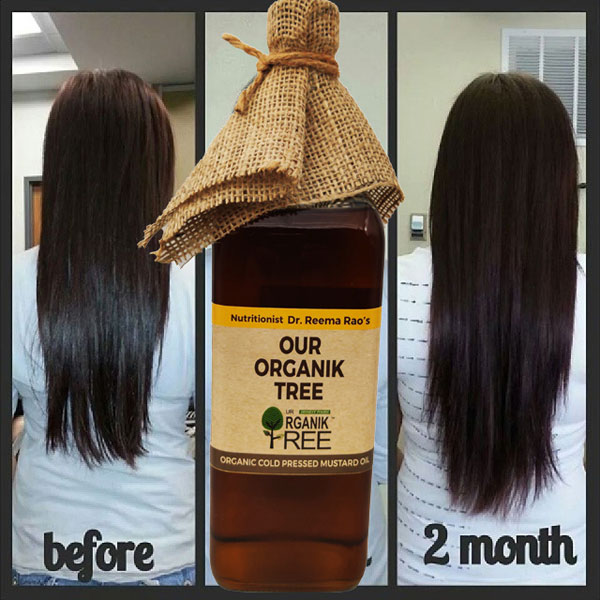 mustard oil hair growth results